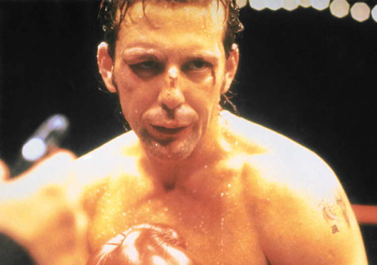 Mickey Rourke Boxing Injuries