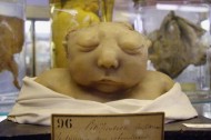 Morbid Medical Antiques at Musée Dupuytren
