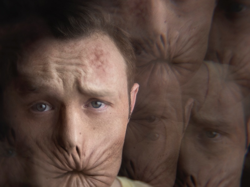 Eugene (“Arseface”) Root